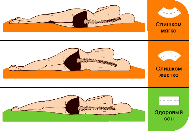 Жорсткість матраца відіграє важливу роль у забезпеченні комфортного сну 12